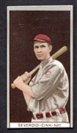 T207 Severoid Cincinnati 